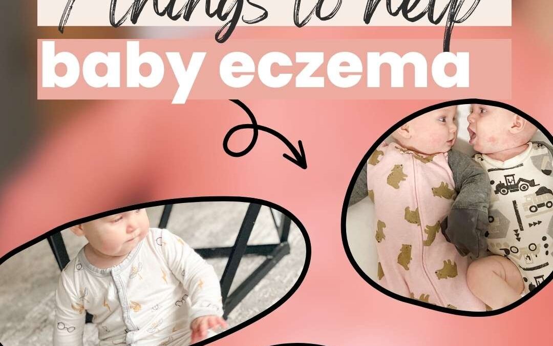 7 things to help baby eczema